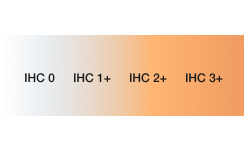 HER2 IHC scores range graphic